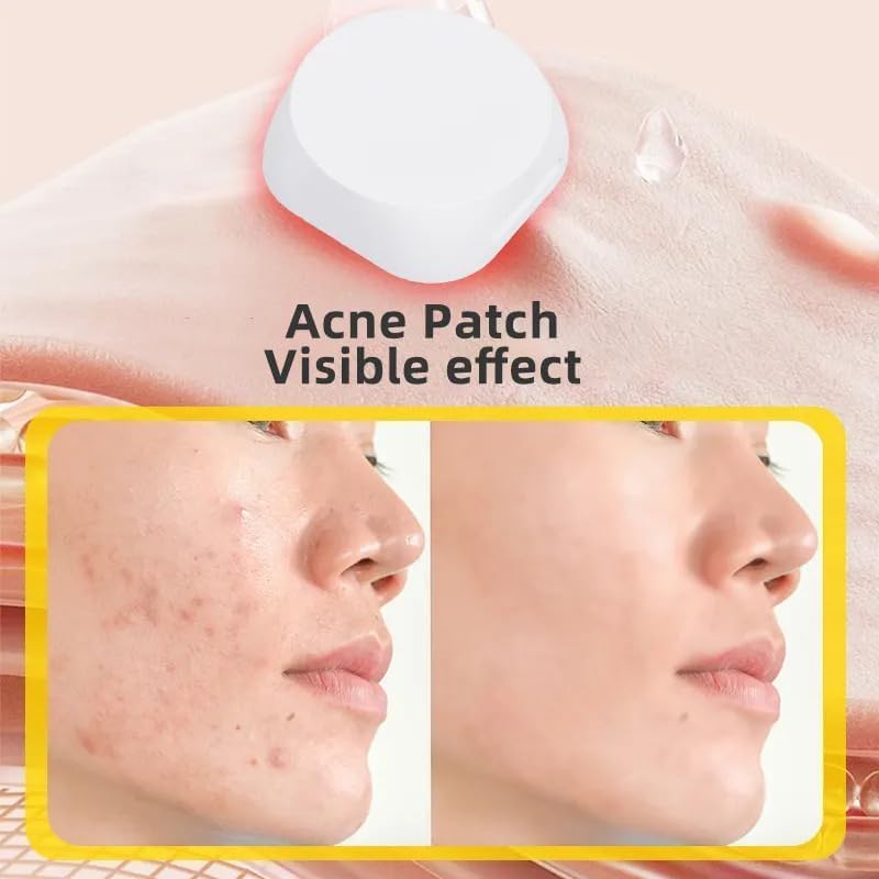 Electronic Acne Patches Light Therapy