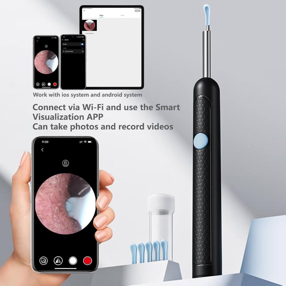 Smart Visual Earwax Cleaner Kit with 1080P WiFi Camera & LED Light