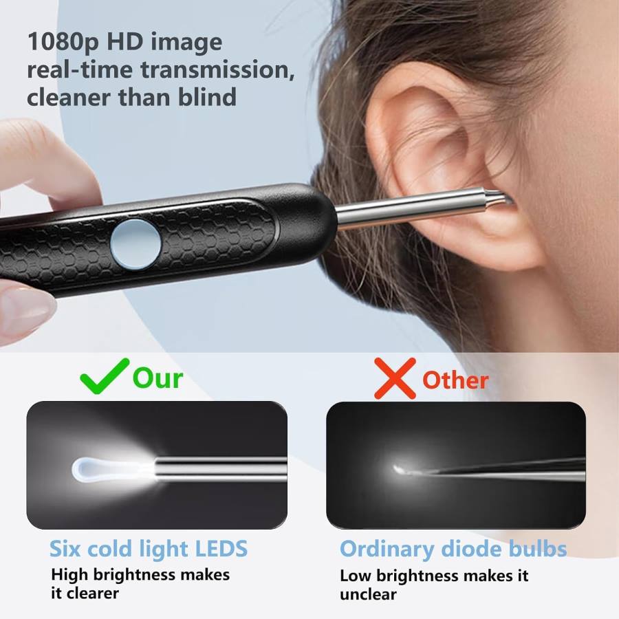 Smart Visual Earwax Cleaner Kit with 1080P WiFi Camera & LED Light